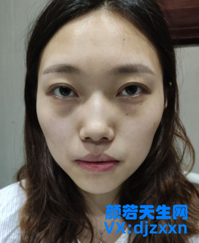 1_副本_副本.png