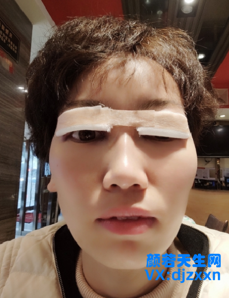 3.png