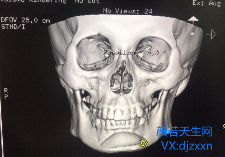 1_副本.png